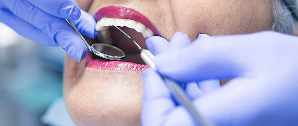 Best Emergency Tooth Extraction  in Brooklyn Heights, OH